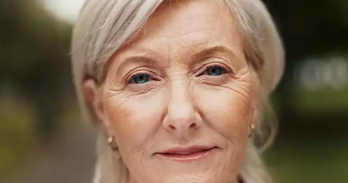 I’m in my 50s. My mother died from Alzheimer’s. Do I need long-term insurance?